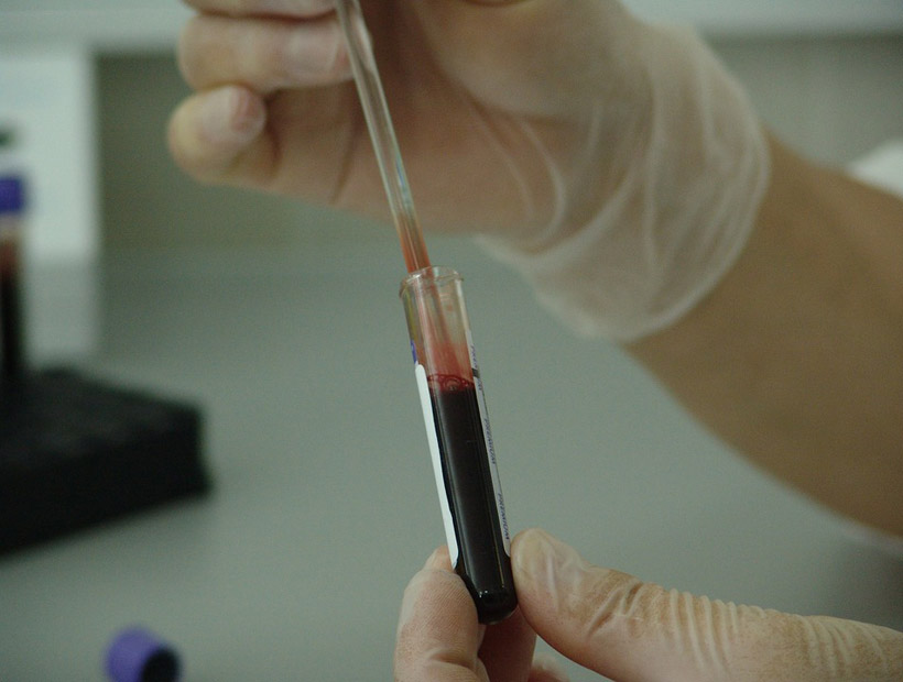 Un análisis de sangre puede detectar el cáncer antes de que se desarrolle